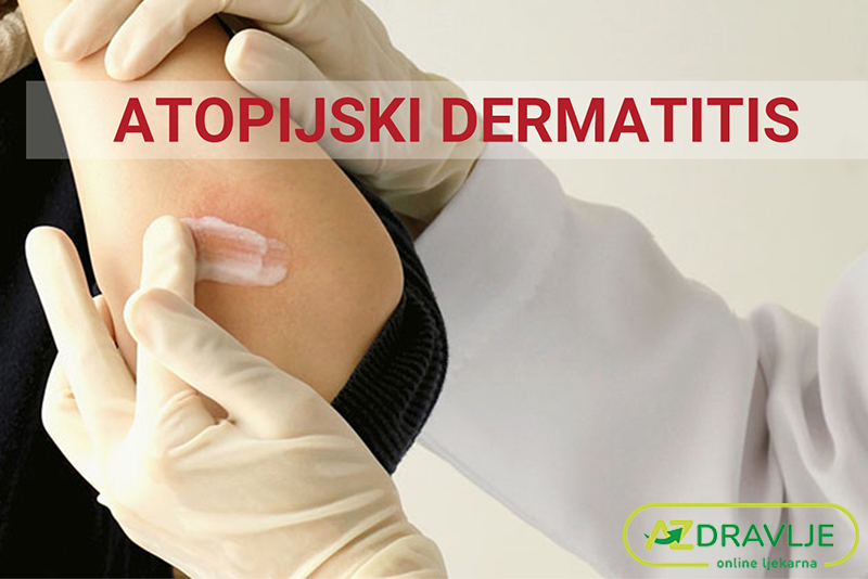 ATOPIJSKI DERMATITIS